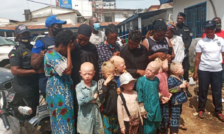 Conakry: Un groupe de femmes arrêté pour l’exploitation des enfants albinos à la mendicité