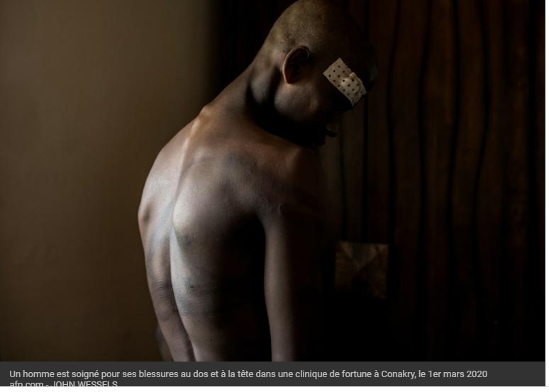 Un homme est soigné pour ses blessures au dos et à la tête dans une clinique de fortune à Conakry, le 1er mars 2020 afp.com - JOHN WESSELS